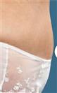 Tummy Tuck (Abdominoplasty) - Centro Médico Quirúrgico Estethica