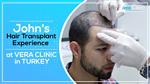 John from California is doing his Hair Transplant in Turkey