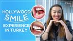 Nadia's Experience With Having Hollywood Smile in Turkey